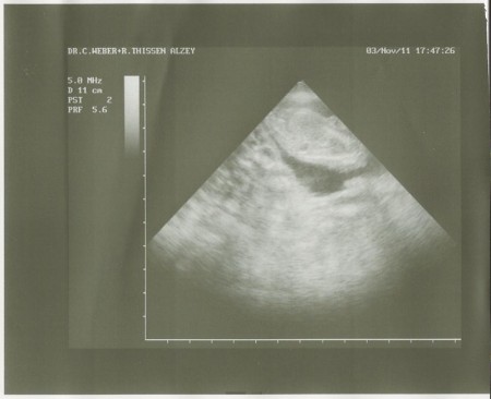 Ultraschall von Petit Basset Griffon Welpen (41. Tag)